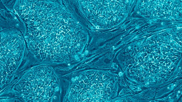 cheats/2011/10/05/stem-cells-created-from-human-embryo/stem-cells-cheat_e9l2yp