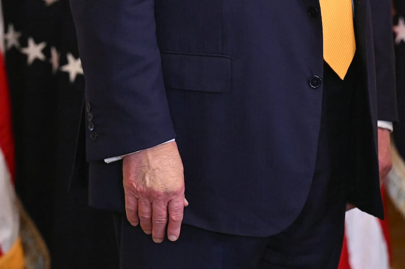 A view of President Donald Trump's right hand as he attends a Black History Month event in the East Room of the White House in Washington, DC, on February 18, 2026.