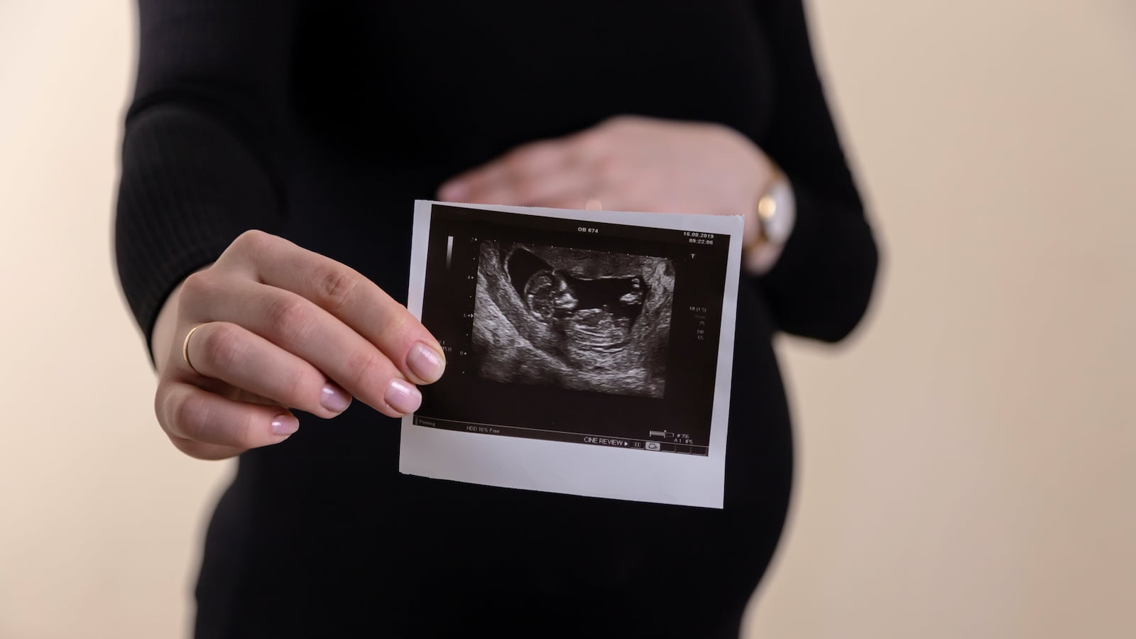 volodymyr-hryshchenko-87ev1NvhDsU-unsplash_ck5mjp