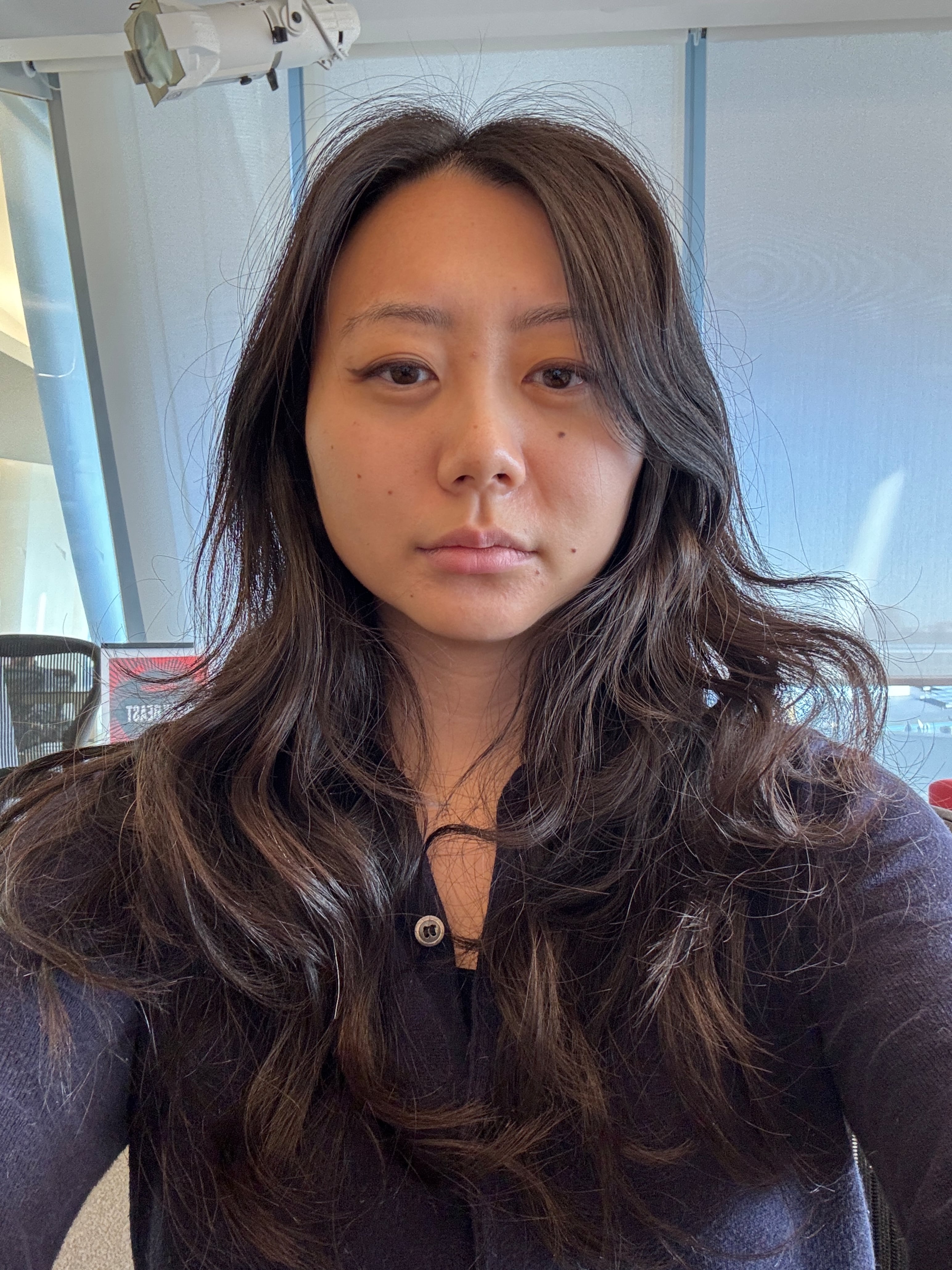 Frowning with baby botox.