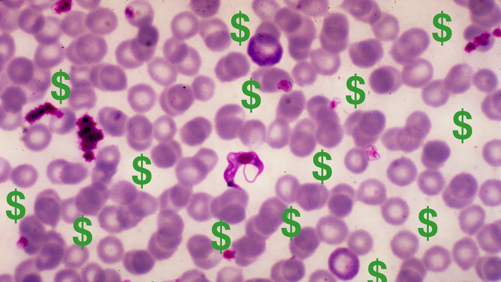 articles/2014/05/10/the-big-bucks-behind-infectious-diseases/140509-parasites-money-sepkowitz-tease_ongtki