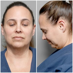 After losing 80 pounds on a GLP-1 medication, Leah noticed loose skin on her face.