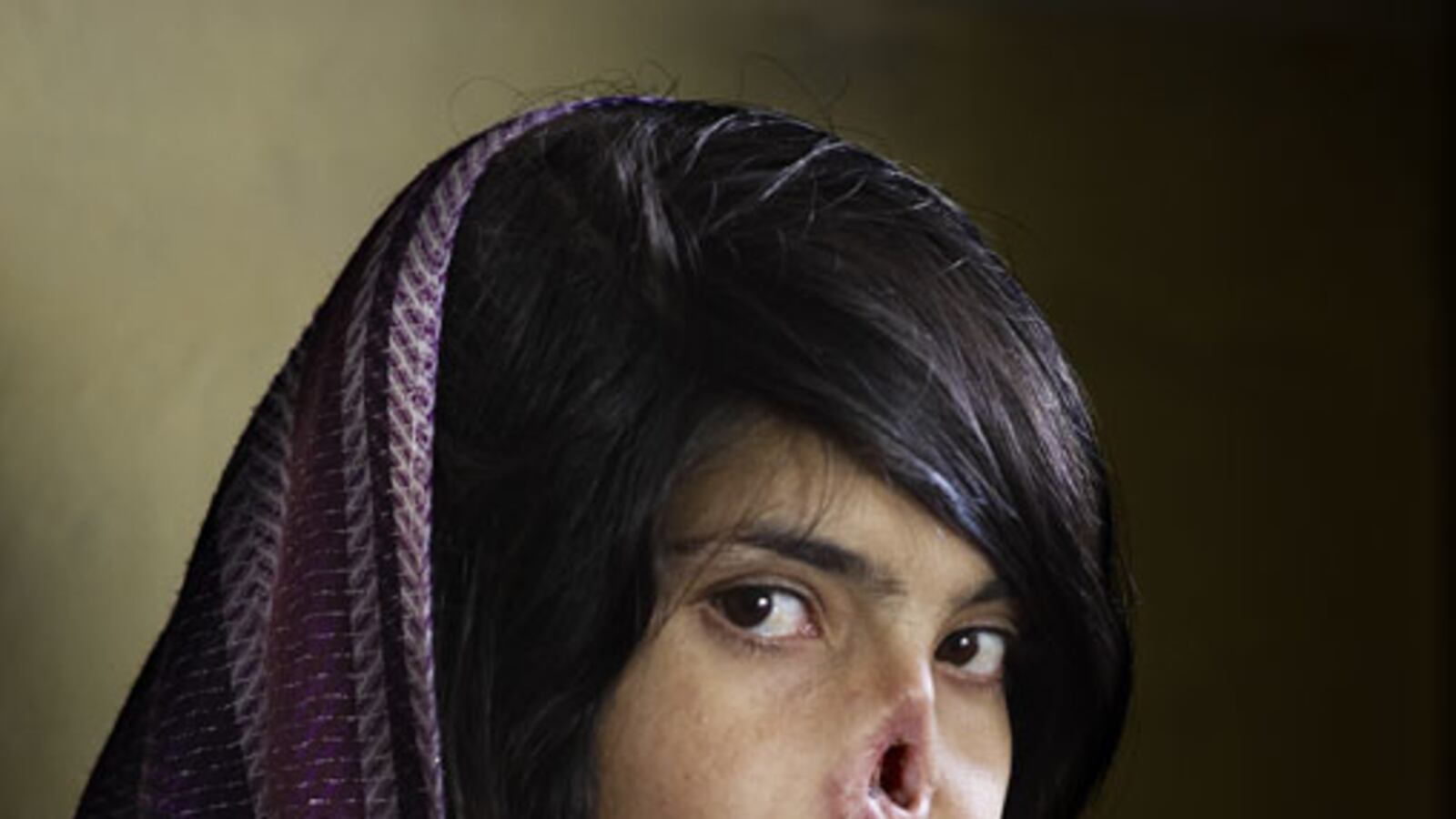 galleries/2011/02/11/world-press-photo-awards/world-press---jodie-bieber_pzxgpd