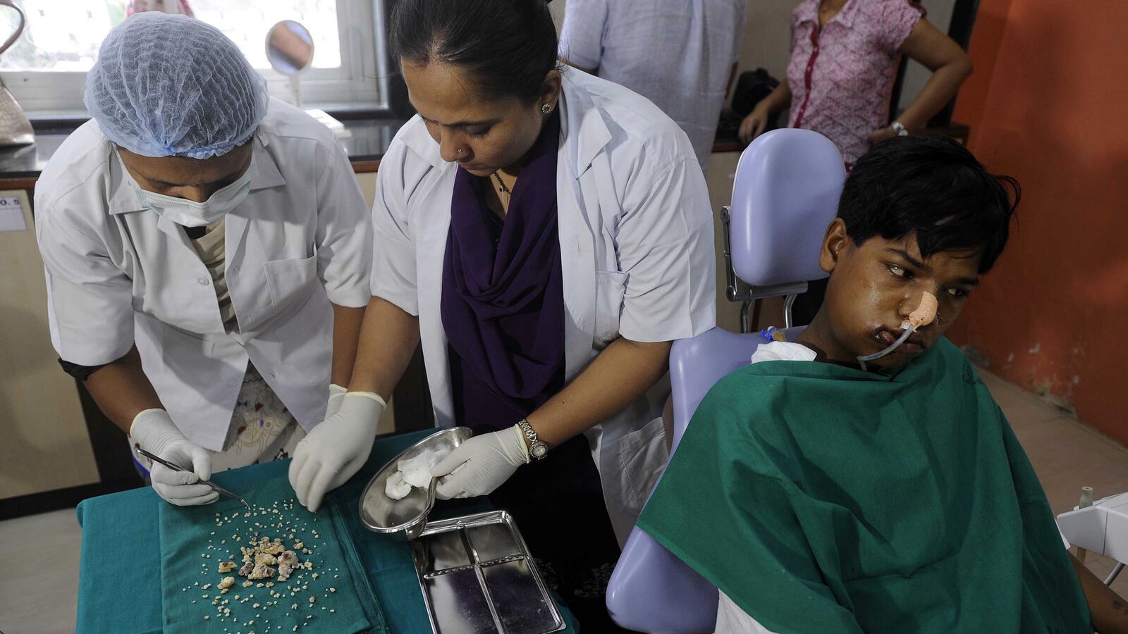 cheats/2014/07/25/232-teeth-removed-from-indian-boy/140725-india-teeth-cheat_vowipa