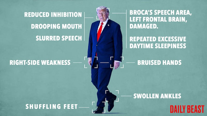 Donald Trump's many medical issues.