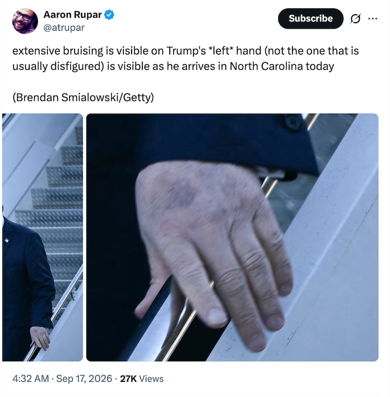 Aaron Rupar/X