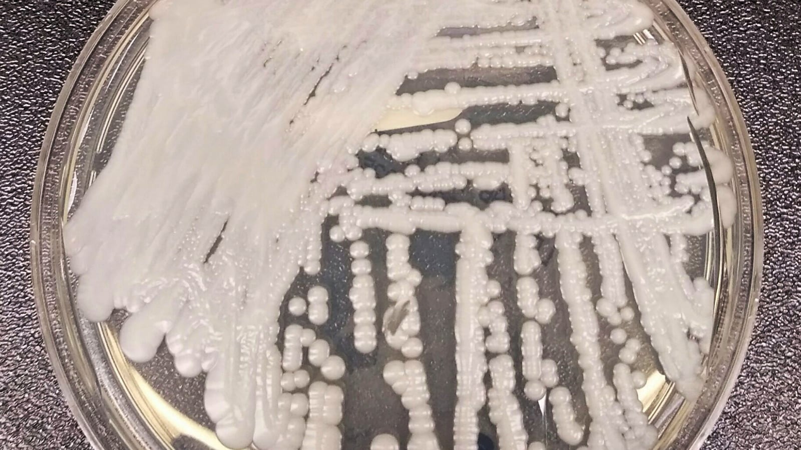A strain of Candida auris cultured in a petri dish at the Centers for Disease Control and Prevention (CDC) is pictured in this undated handout photo obtained by Reuters on April 9, 2019.