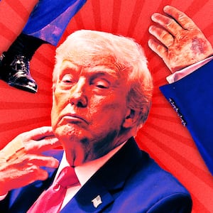 A photo illustration of Donald Trump, his bruised hand, and cankles on red background.