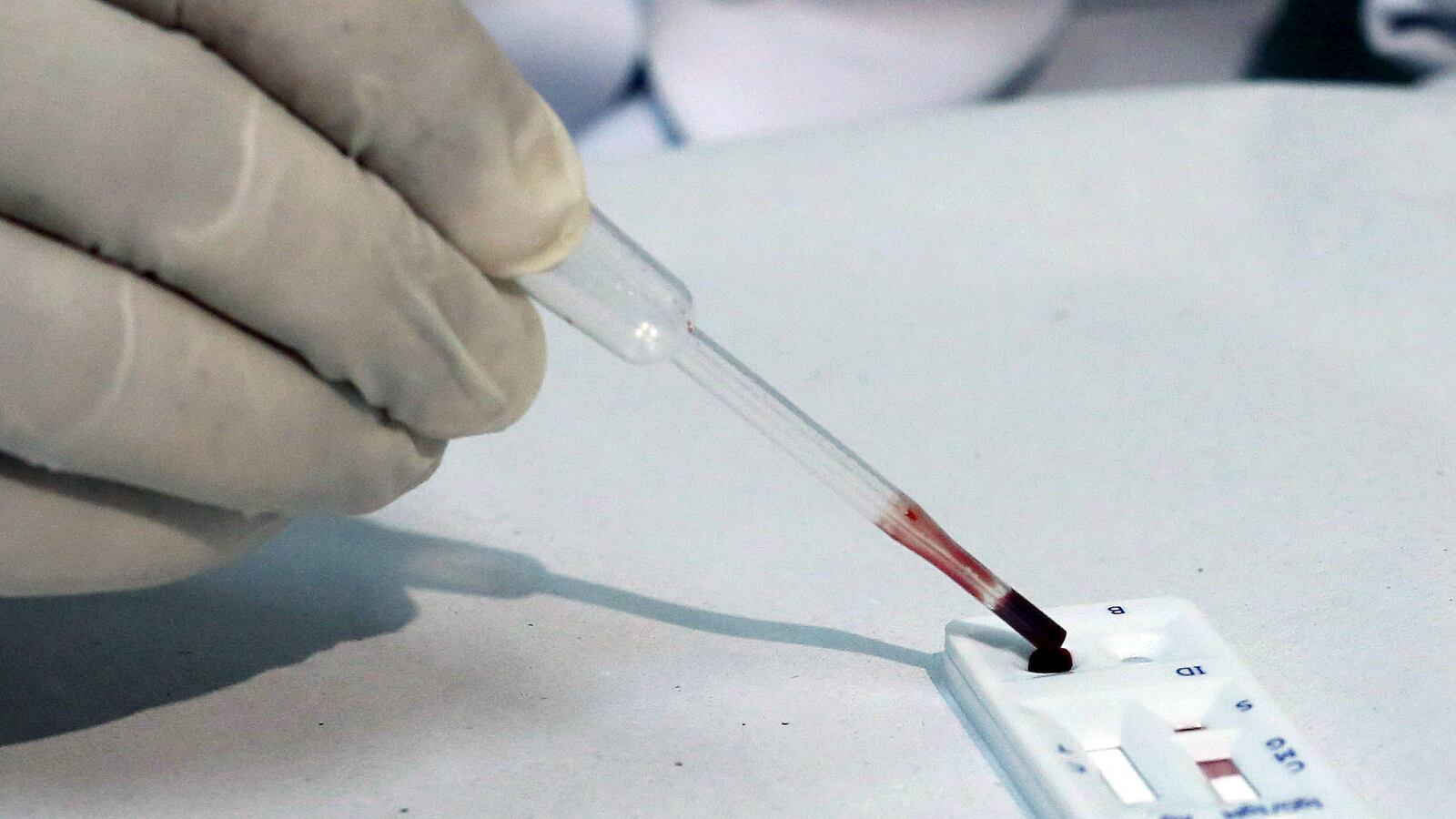 cheats/2016/02/11/usoc-to-tap-disease-specialists-for-zika/160211-zika-usoc-olympics-cheat_wndmwo