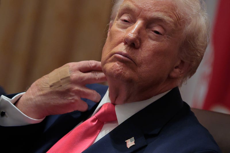 Trump wore bandages on the back of his hand during a December meeting of his cabinet in which he struggled to keep his eyes open.