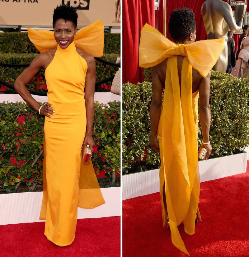 galleries/2016/01/30/sag-red-carpet-2016-winners-and-losers/160130-sag-20a_wlbeuk