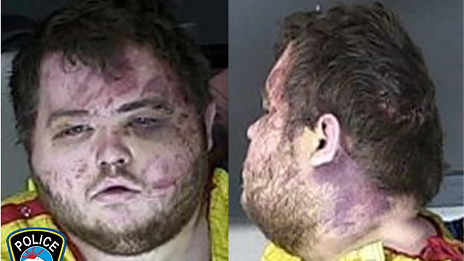 Anderson Lee Aldrich, 22, the suspect in the mass shooting that killed five people and wounded 17 at an LGBTQ nightclub