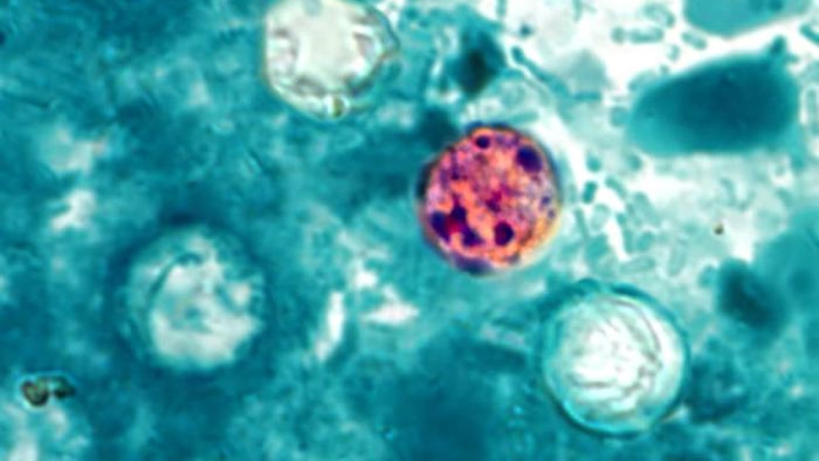CDC Image