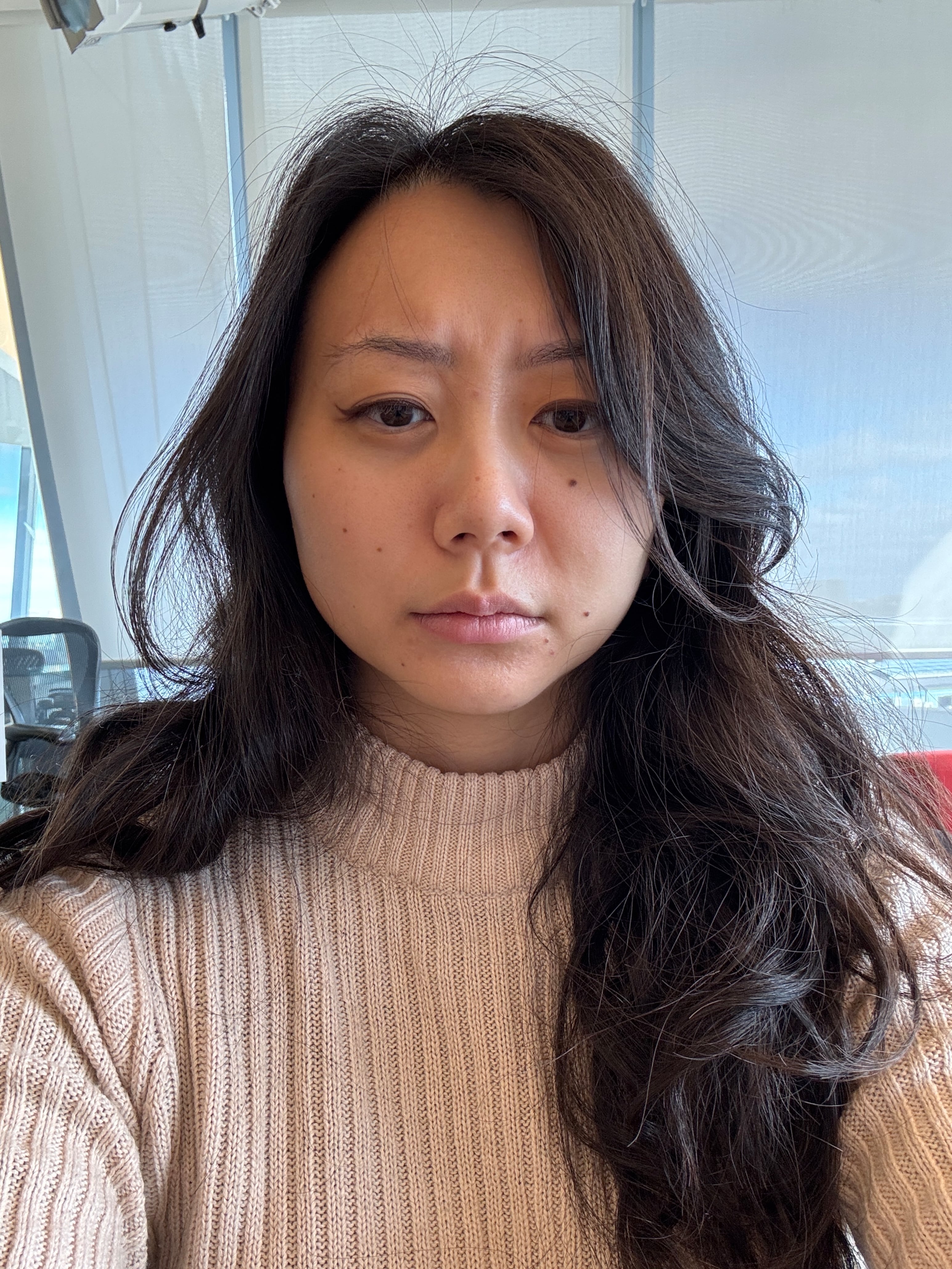 Frowning with baby botox.