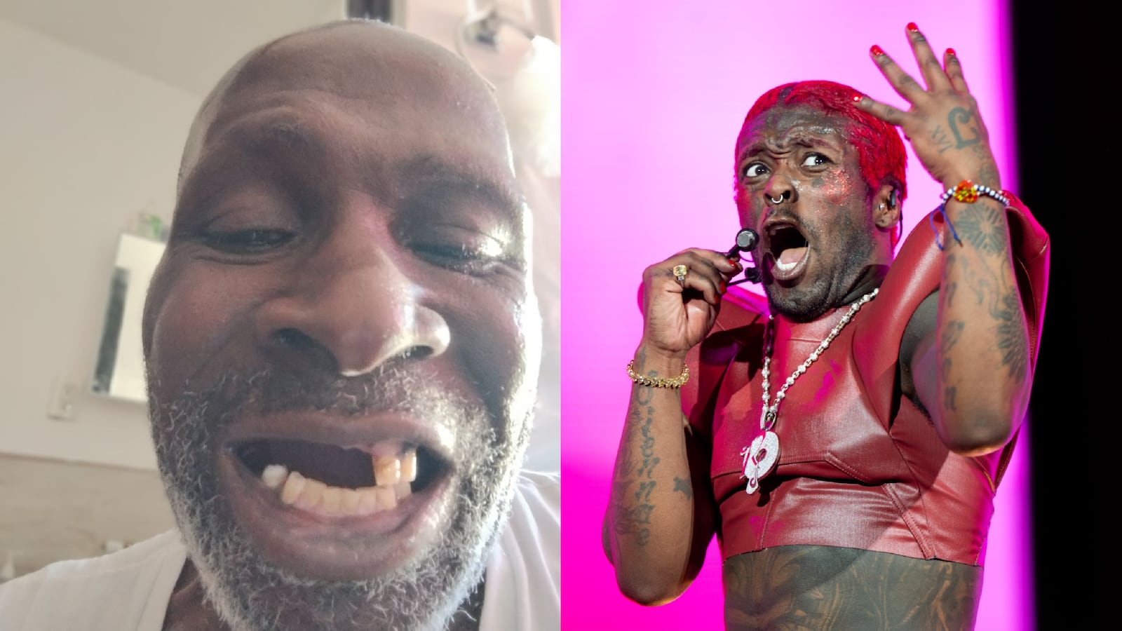 Side-by-side photos of Abdullah Ali, with missing teeth, and rapper Lil Uzi Vert onstage at Coachella.