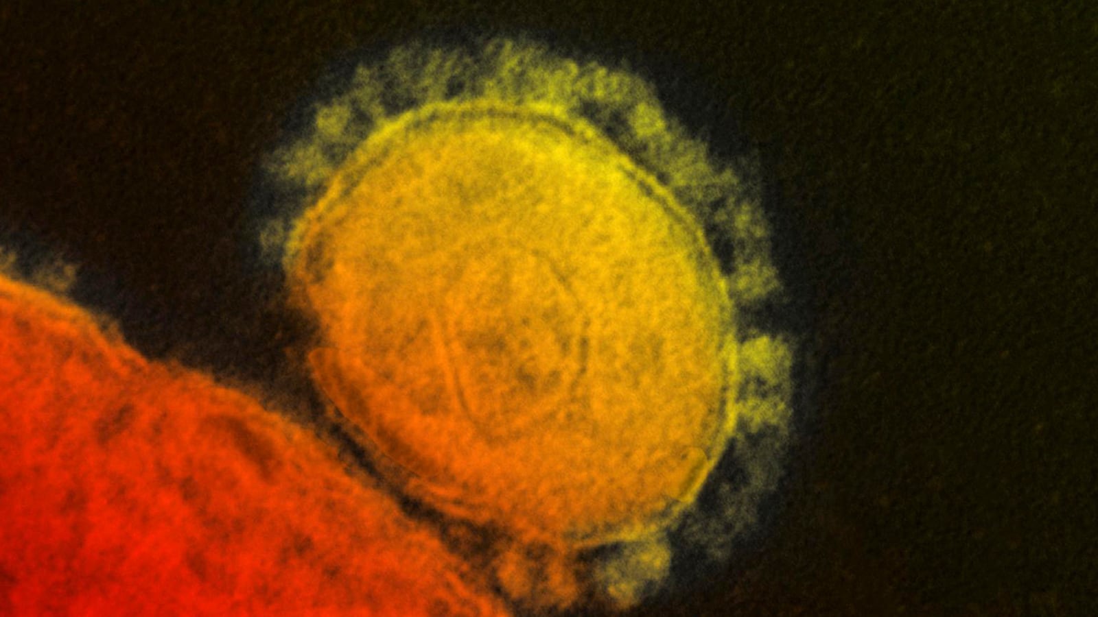 cheats/2015/06/18/thailand-reports-first-case-of-mers/140518-mers-virus-cheat_djvbyi