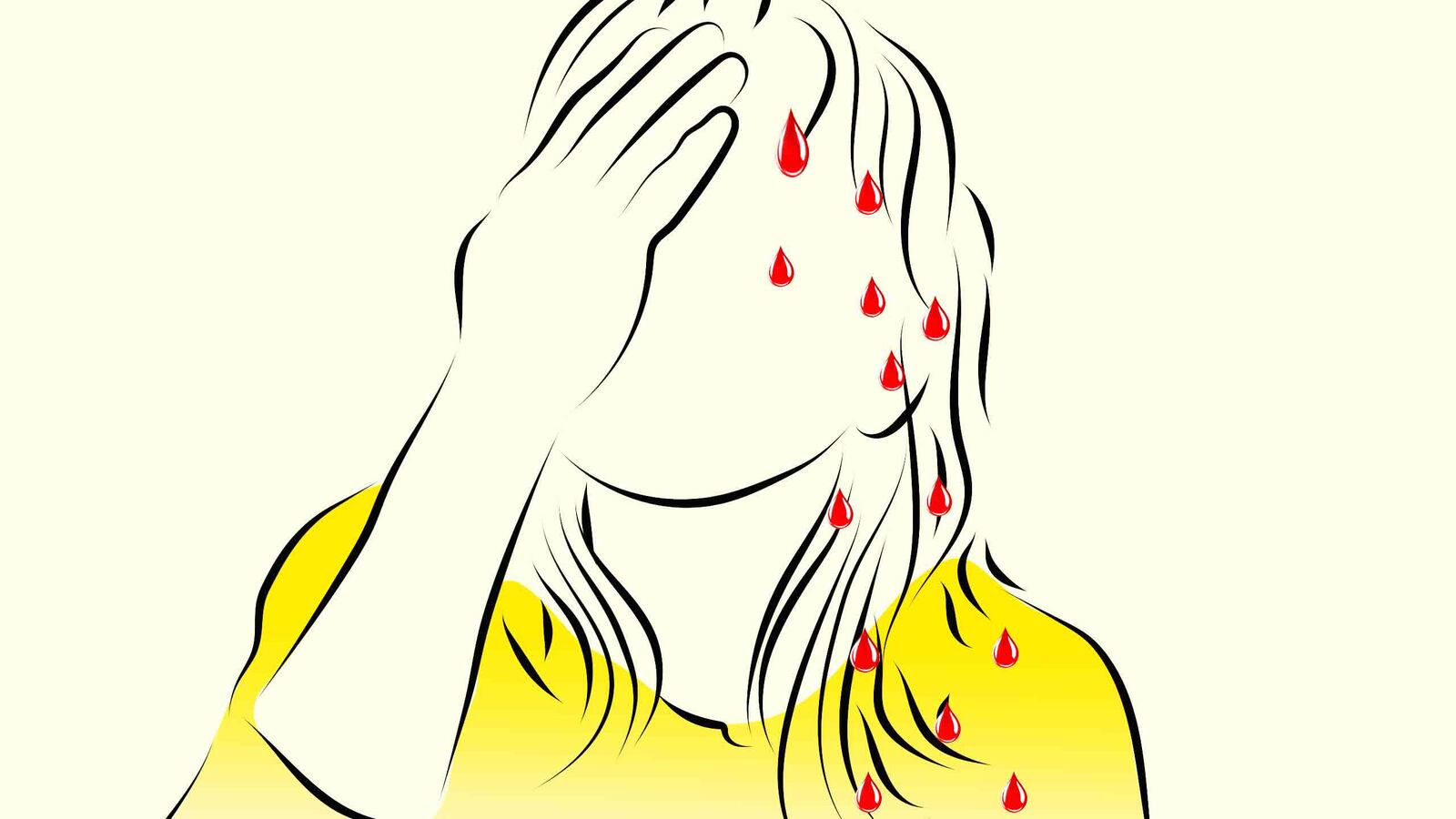 171111-moss-bleeding-sweat-lede_sjq405