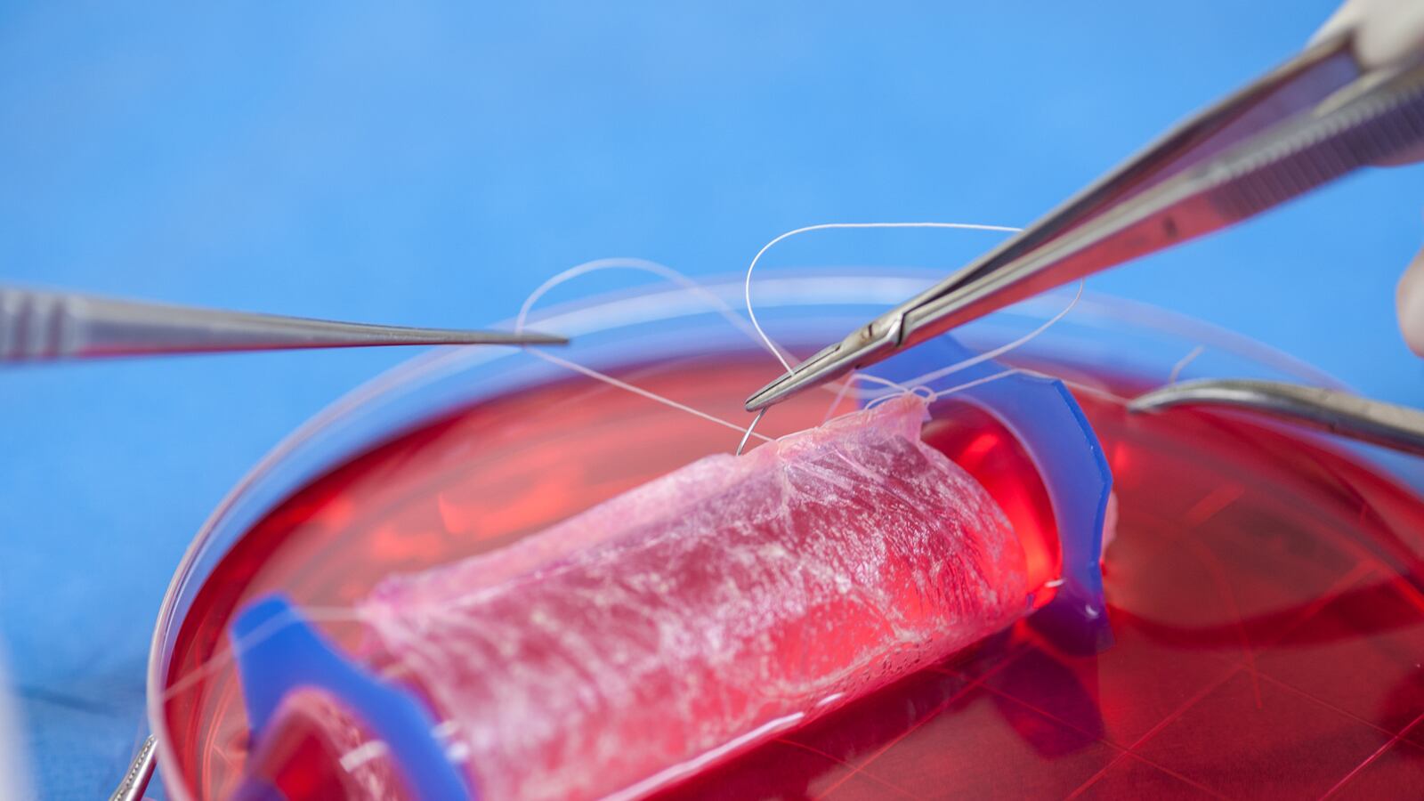 cheats/2014/04/10/drs-implant-lab-grown-vaginas/140411-vagina-lab-cheat_nqsy5s