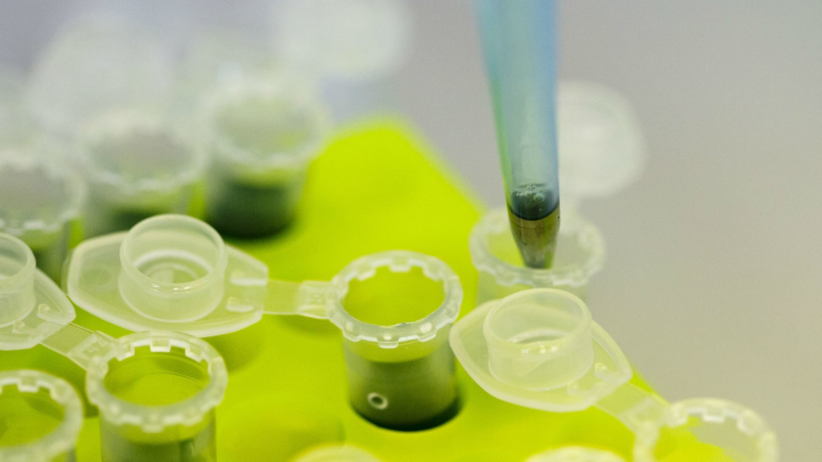 cheats/2014/11/26/ebola-vaccine-passes-1st-hurdle/141126-ebolavaccine-cheat_r64oyv