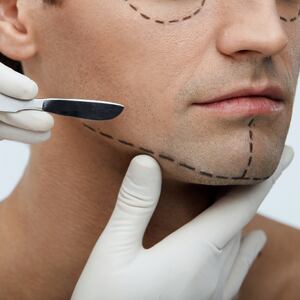 A man undergoes a cosmetic surgery consultation, with markings drawn onto his face.