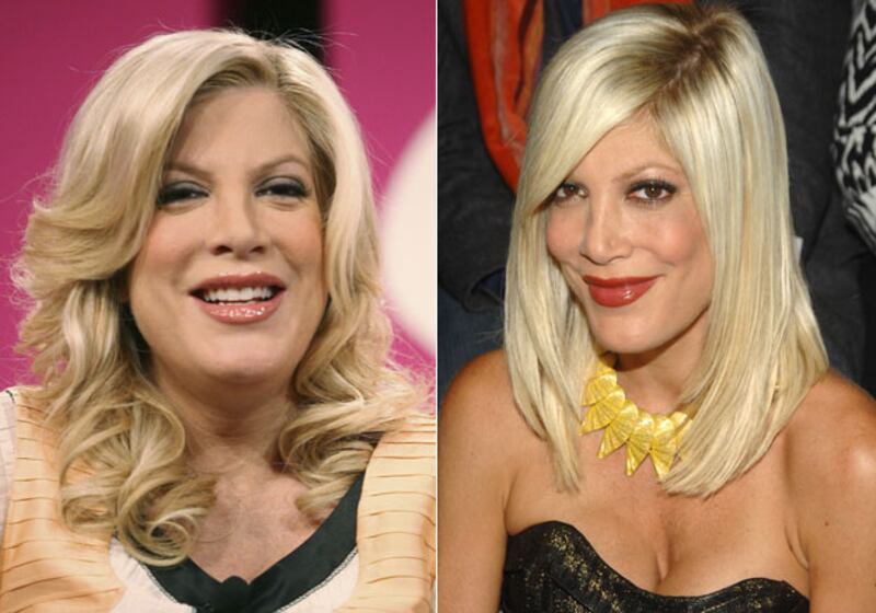 galleries/2010/01/09/celebrity-weight-loss/celebrity-weight-loss---tori-spelling_wbhlsv