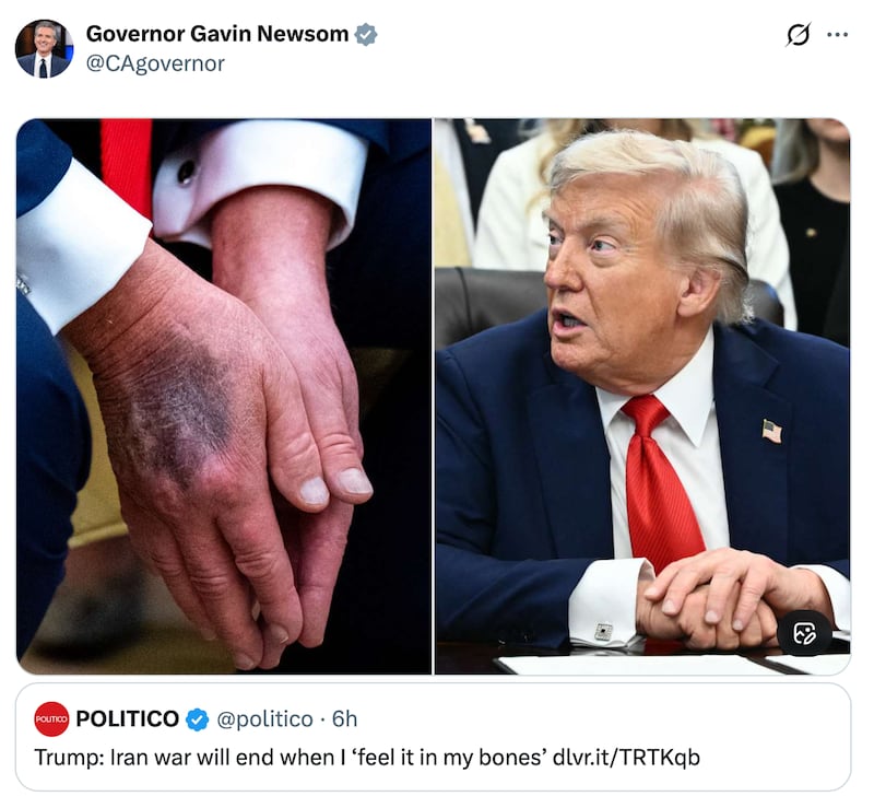 A post from the official Governor Gavin Newsom X account showing a side by side pictures of Trump's bruised hand on the left, and sitting at his desk in the Oval Office on the right.