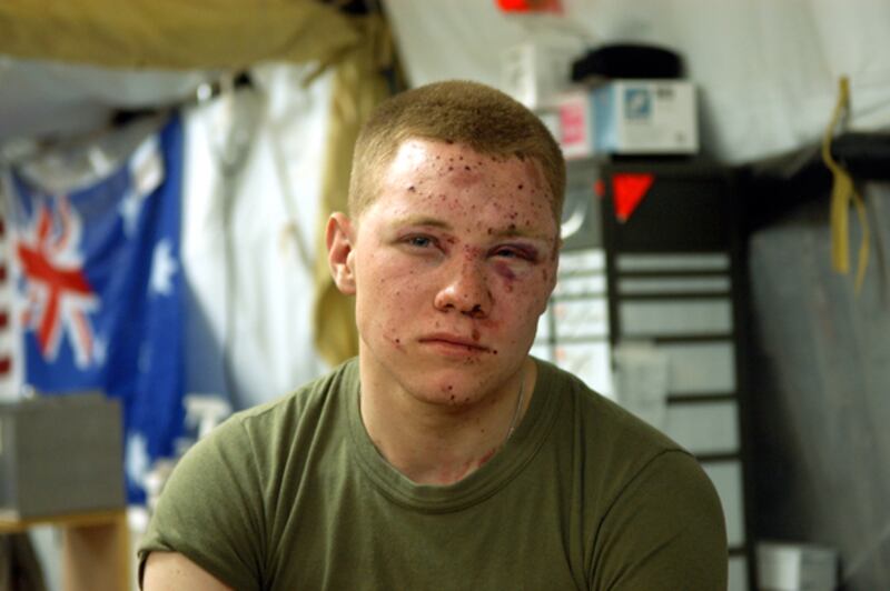 galleries/2009/11/30/groundbreaking-care-for-soliders-in-iraq/iraq-medi6_k1tms0