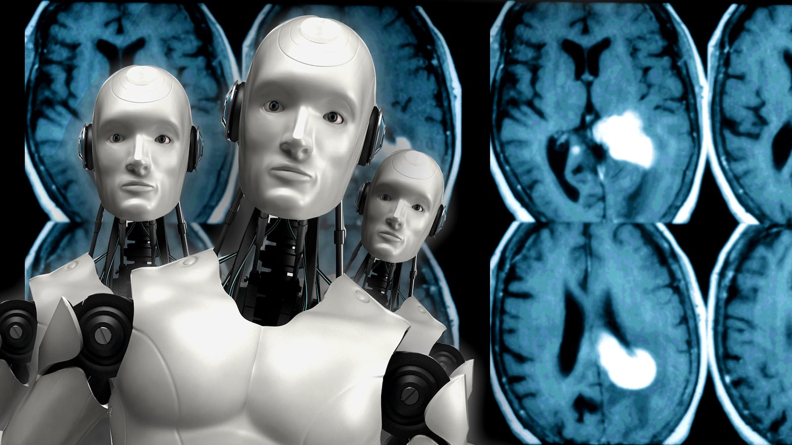 171208-Patel-AI-making-colonoscopies-less-of-pain-hero_ubqylp