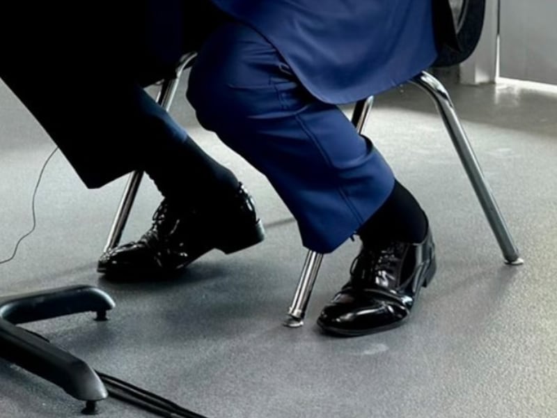 Donald Trump's swollen ankles are highlighted in a X post.