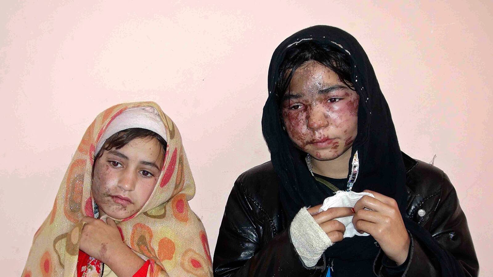 cheats/2011/11/30/afghan-family-attacked-with-acid/afghan-acid-attack-cheat_nahzfy