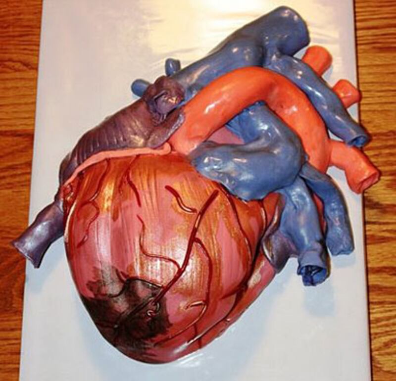 galleries/2009/09/01/world-s-ugliest-cakes/cake-wrecks---heart-attack_dkjmeg