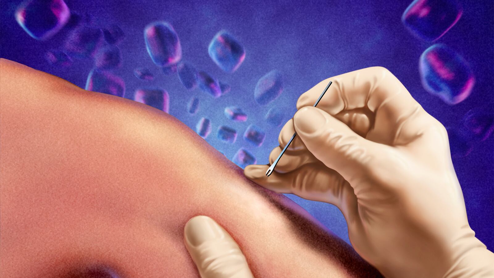 190317-richtel-immune-system-tease_pgmy9n