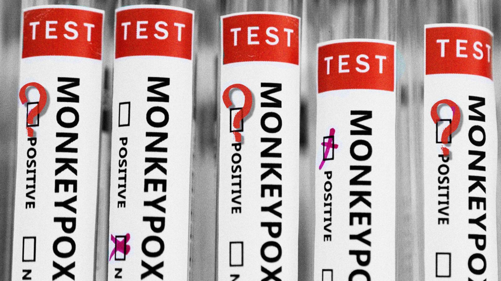 220809-bixby-monkeypox-hero_jgfy1q