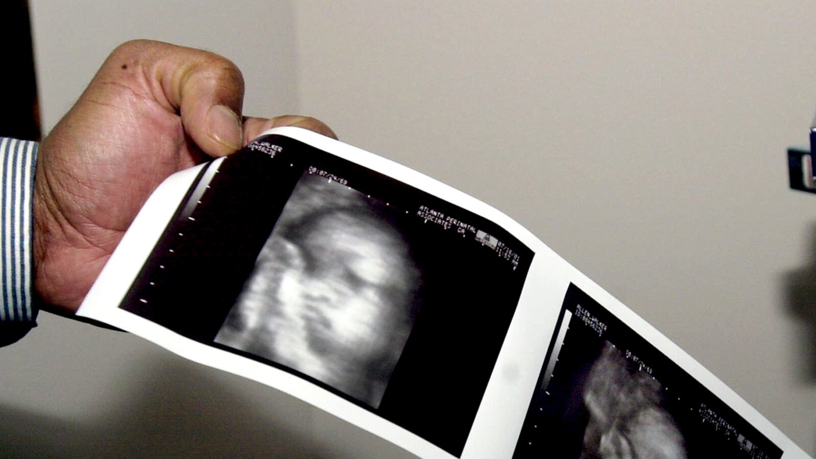 articles/2012/05/30/ronald-reagan-the-silent-scream-and-the-slow-rise-of-fetal-pain/fetus-pain-fight-yarrow_jbgdle