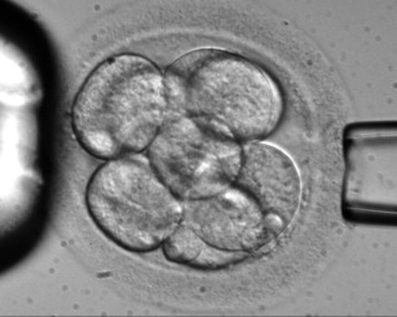 galleries/2009/11/24/our-list-most-startling-medical-discoveries-of-the-last-10-years/last-decade-med-innovations---stem-cell_lsh38q