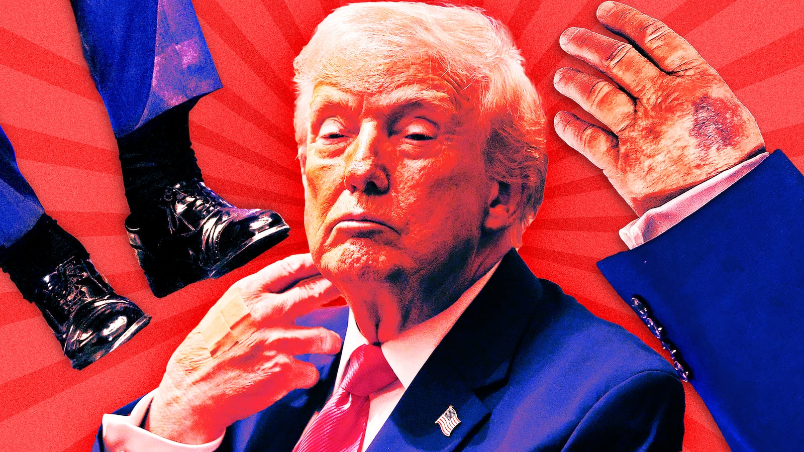 A photo illustration of Donald Trump, his bruised hand, and cankles on red background.