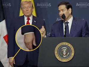 Donald Trump's hand appears to have make-up to hide bruising.