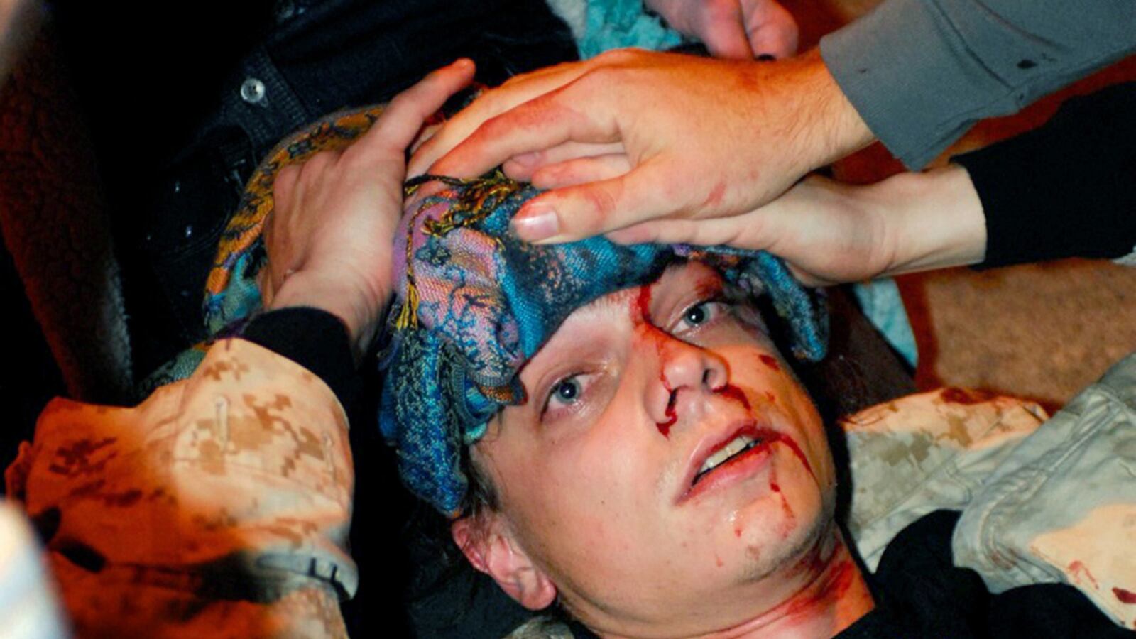 cheats/2011/10/28/oakland-protester-suffers-brain-damage/scott-olsen-damage-cheat_tjugp5