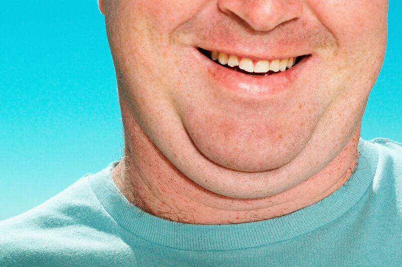 articles/2013/09/17/kythera-helps-you-melt-your-double-chin-no-diet-or-surgery-required/130917-gross-double-chin-tease-embed_en9oz8