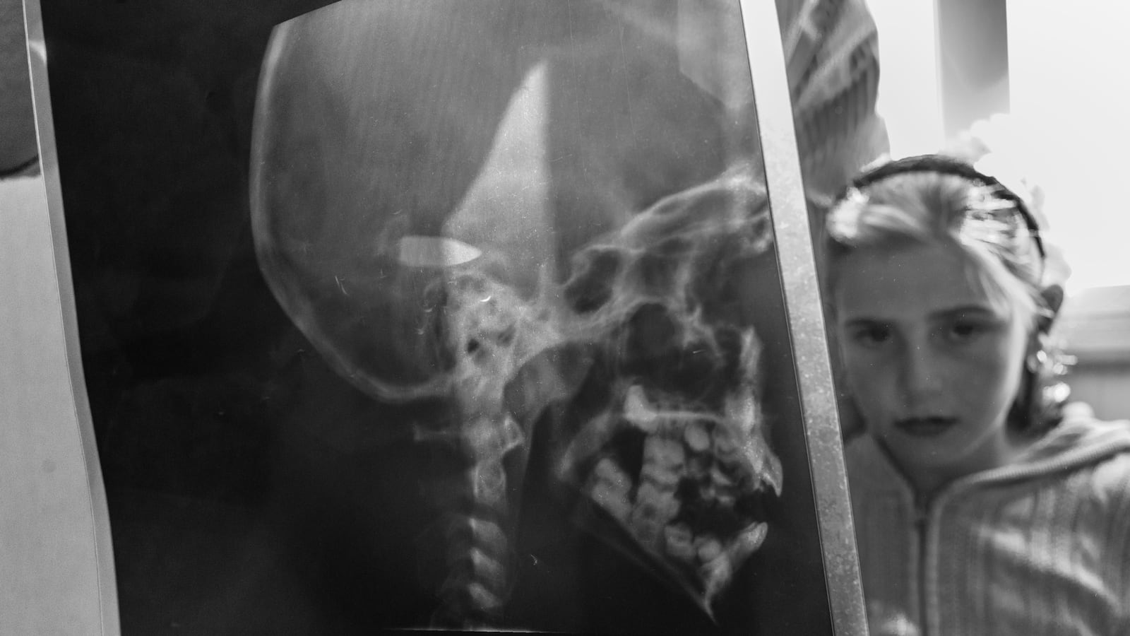 articles/2013/11/29/the-little-syrian-girl-with-a-bullet-in-her-head/131127-beals-syria-tease_f1trnr