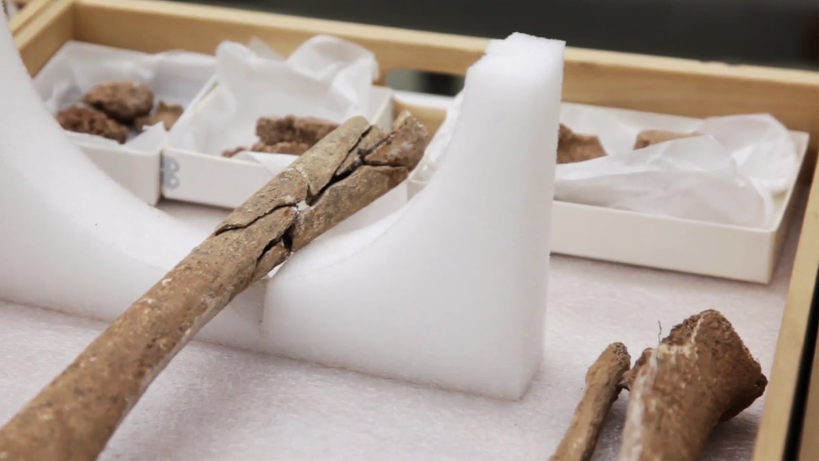 180620-Civil_War_Bones_Discovered_in_Limb_Burial_Pit-hero_mqy484