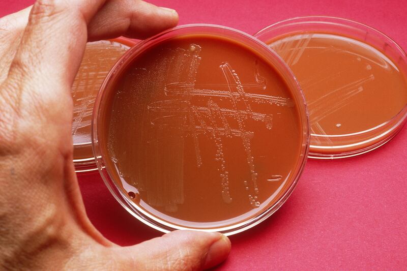 articles/2013/05/07/drug-resistant-gonorrhea-the-sex-superbug-is-not-worse-than-aids/130506-Sepkowitz-Gonorrhea-tease_kslmdw