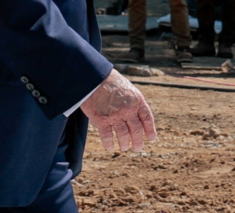 A close-up of Trump's hand as seen Wednesday morning.