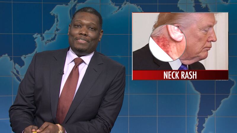 SNL, Michael Che on Donald Trump's neck rash.