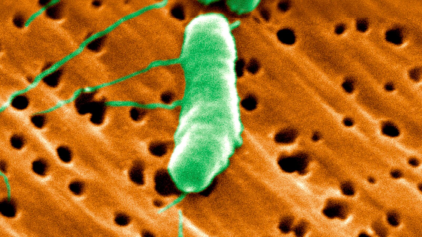 articles/2015/06/26/flesh-eating-bacteria-back-for-summer/150526-joiner-bacteria-tease_hfv91r