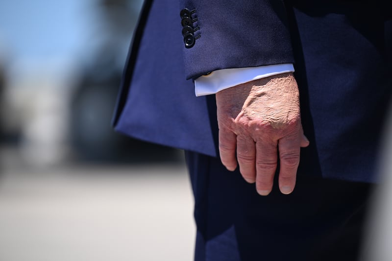 A detailed view of the hand of U.S. President Donald Trump before he boards Air Force One at the Palm Beach International Airport on April 25, 2026 in West Palm Beach, Florida. President Trump is returning to Washington after hosting a cryptocurrency conference at his Mar-a-Lago estate in Palm Beach Florida .