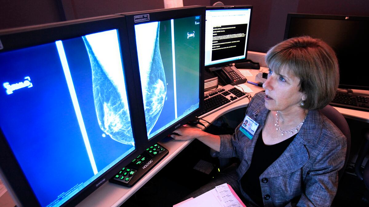 cheats/2012/04/01/study-hormones-up-breast-cancer-risk/mammogram-screen-cheat_bqfc2t