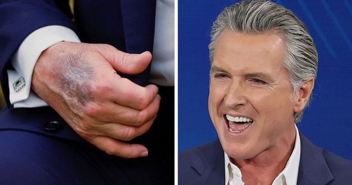 Newsom Trolls Trump’s ‘Perfect Health’ With Gnarly Photo