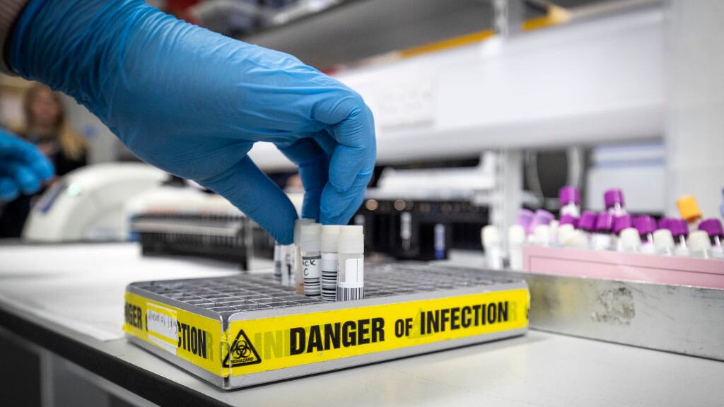 Clinical support technician Douglas Condie extracts viruses from swab samples so that the genetic structure of a virus can be analysed and identified in the coronavirus testing laboratory at Glasgow Royal Infirmary in Scotland.