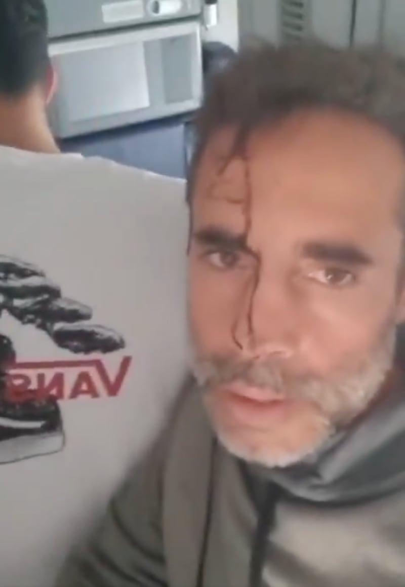 A bloodied passenger from the flight.